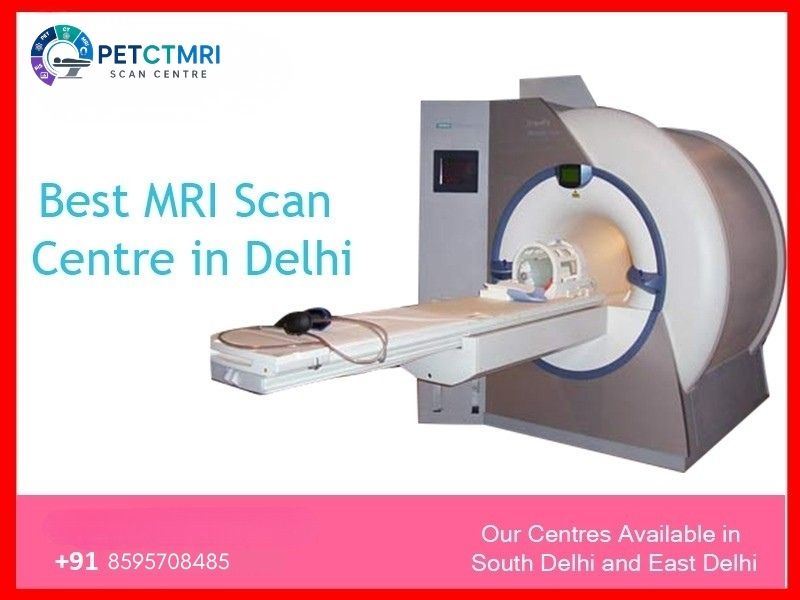 MRI SCAN