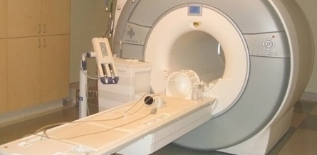 MRI BRAIN
